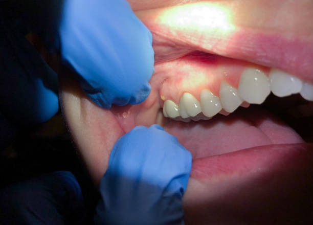 Best Mobile Emergency Dentist in Riverside, MD
